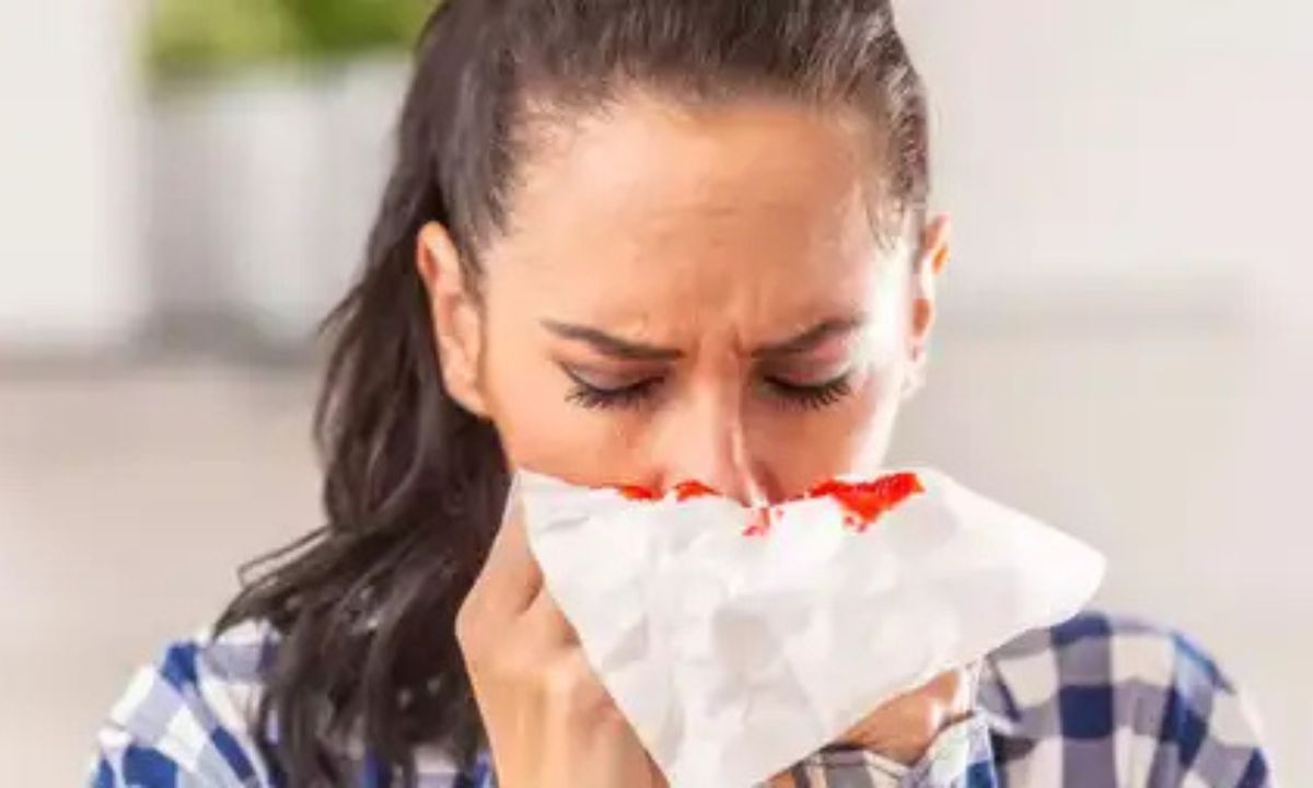 Causes, precautions and treatment of nose bleeding in summer