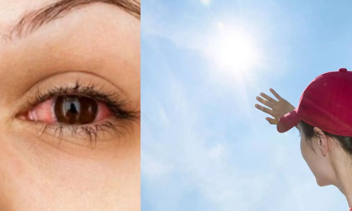 Protect your eyes from heat and heat wave: