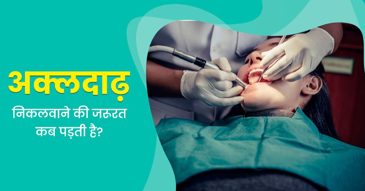 अक्ल दाढ़-दांत में इन्फेक्शन का खतरा कब होता है और इन्हें कब निकलवाना चाहिए?