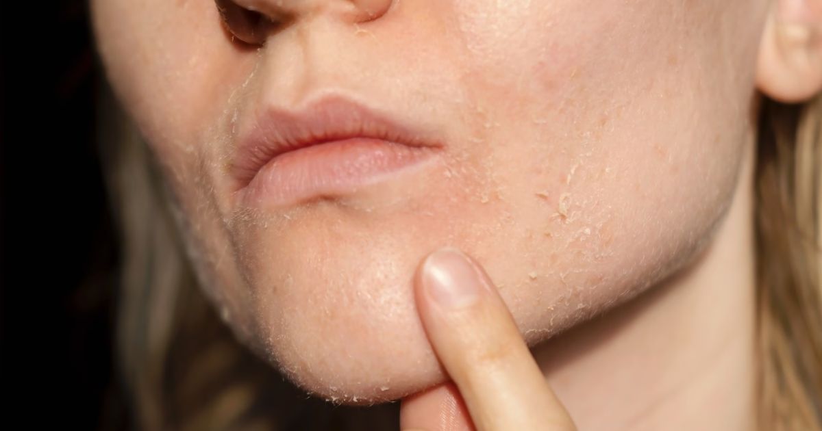 सर्दियों