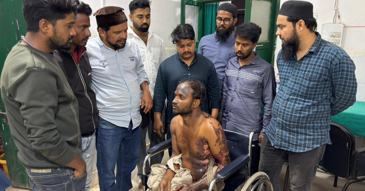चक्रधरपुर में गंभीर रूप से जला व्यक्ति मिला, समाजसेवी बैरम खान ने अस्पताल पहुंचाकर बचाई जान