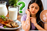 Fish and Milk Myth: क्या मछली खाने के बाद दूध पीने से हो जाते हैं सफेद दाग? जानिए क्या है सच