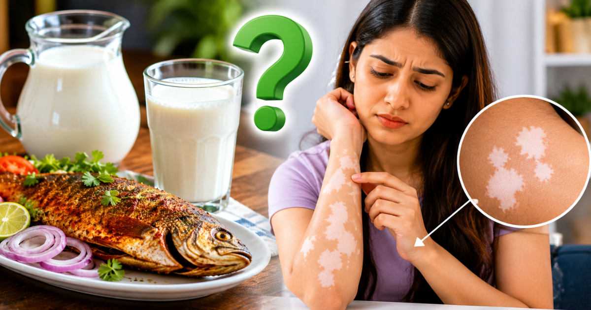 Fish and Milk Myth: क्या मछली खाने के बाद दूध पीने से हो जाते हैं सफेद दाग? जानिए क्या है सच