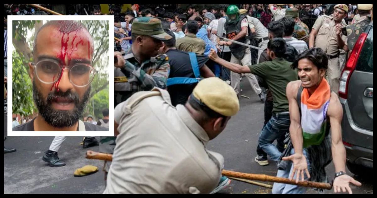 CJP प्रदर्शन में घायल हुए यूट्यूबर PeeingHuman, 11 साल बाद पहली बार दिखाया चेहरा