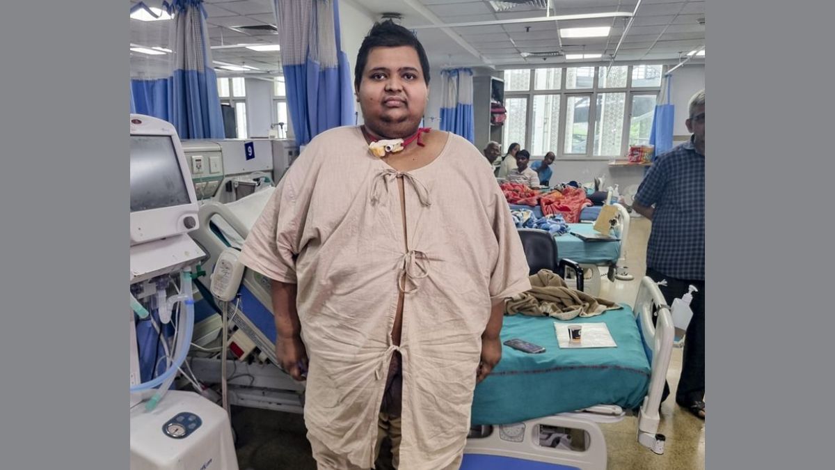 AIIMS Delhi 209 Kg Patient Successful Surgery