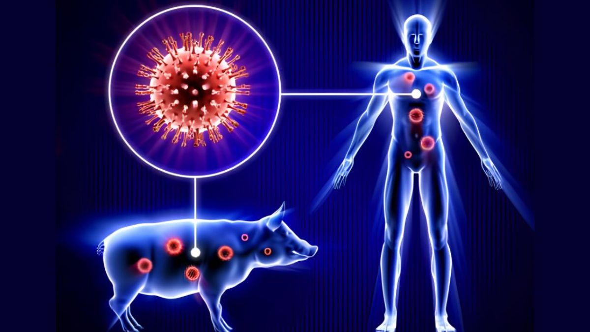 Jharkhand Swine Flu