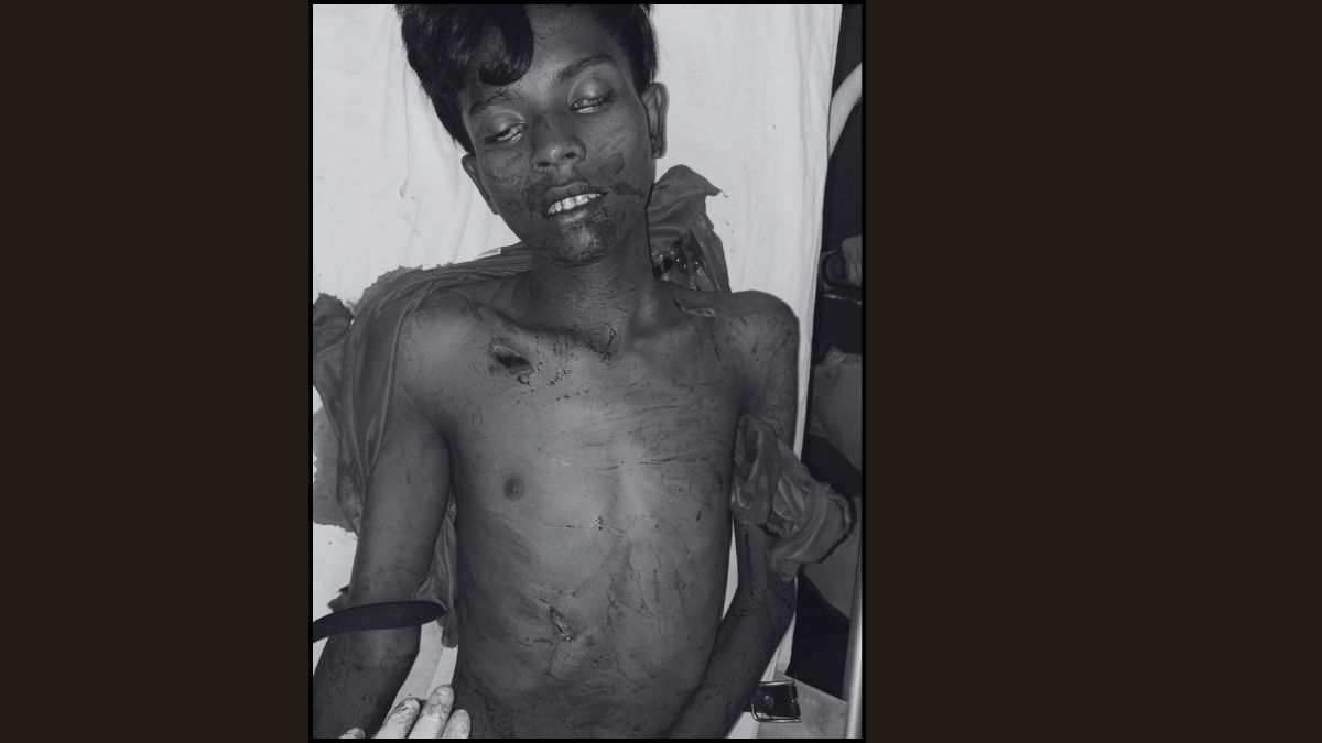 Teenager stabbed to death near Kadma toll bridge